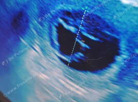 Mobile ultrasound and microchipping