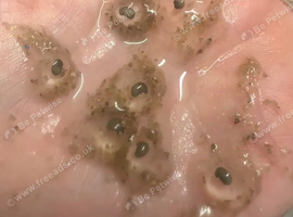 Axolotls eggs