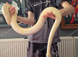 Albino girl