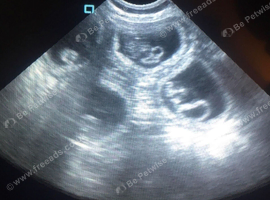 Pregnancy scanning for dogs