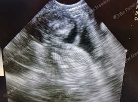 Mobile Animal Ultrasound pregnancy  Scanner