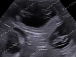 K9 pregnancy ultrasound and microchipping