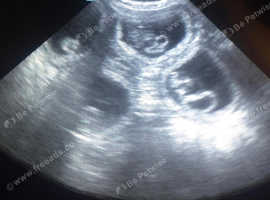 Animal Ultrasound scanning&pound;30