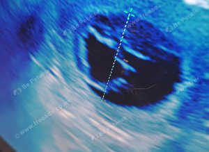 Mobile ultrasound and microchipping