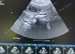 Pet Microchipping & Ultrasound