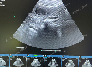 Pet Microchipping & Ultrasound