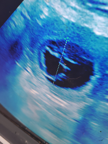 Mobile ultrasound and microchipping