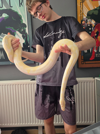 Albino girl