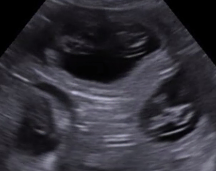 K9 pregnancy ultrasound and microchipping