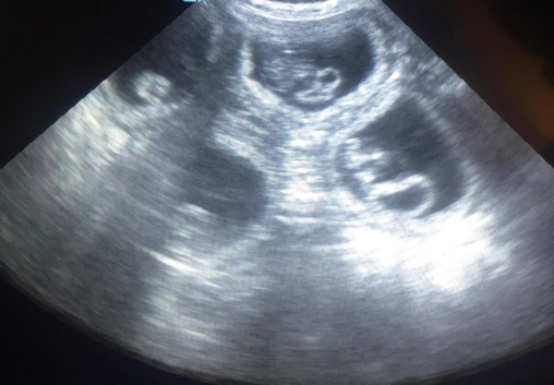 Animal Ultrasound scanning&pound;30