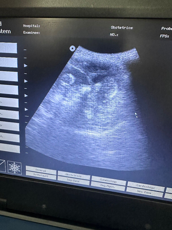 Pregnancy confirmation scanning