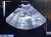 Mobile ultrasounds
