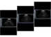 DC Fertility Services Ultrasound Scanning