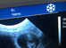 Mobile canine ultrasound scanning