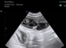 Maddie due 5 puppie on 22nd of August