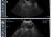 DC Fertility Services Ultrasound Scanning