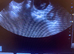 Pet microchipping - Pregnancy Scans