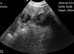 DC Fertility Mircochipping Services