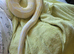 Albino girl