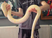 Albino girl