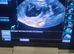 Canine ultrasound scanning