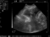 Mobile Ultrasound and Microchipping service