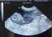 Mobile ultrasounds