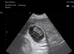 Maddie due 5 puppie on 22nd of August