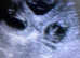 Pet Microchipping and Ultrasound scanning