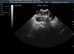 Pet Pregnancy Ultrasound