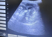 Pregnancy confirmation scanning